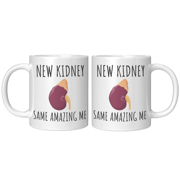 Kidney Recipient Mug - Kidney Transplant Gift - Kidney Surgery Present - New Kidney Same Amazing Me - 11oz